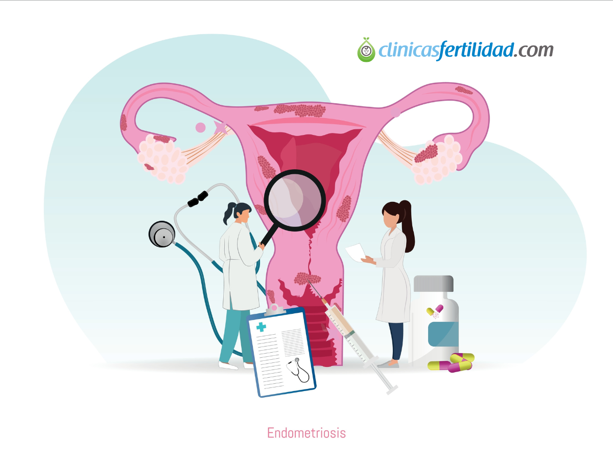 Endometriosis y Embarazo: Desafíos y Posibilidades para Concebir